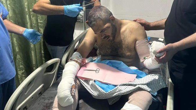 Palestinian Hamas critic beaten by masked men in Gaza